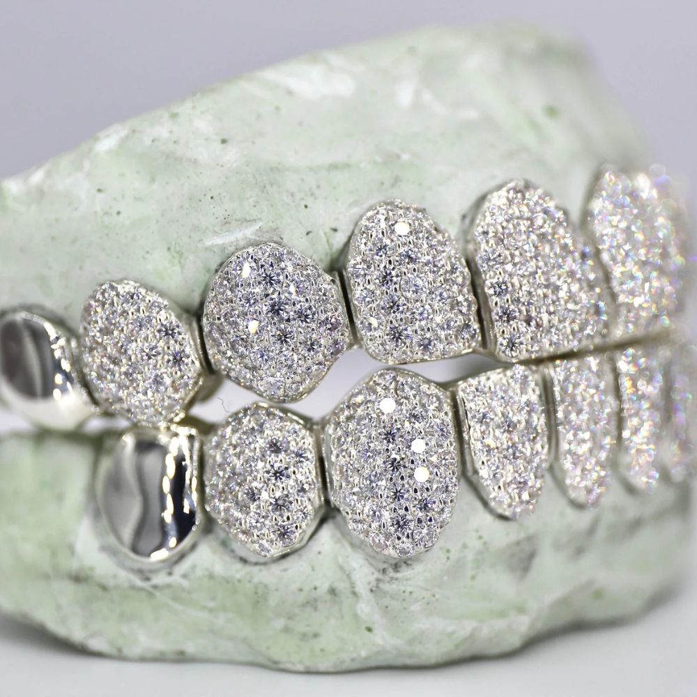 Hip Hop Iced Out Moissanite Customize Grillz
