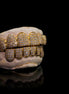 Custom Moissnaite Diamond Grillz In 14K Yellow Gold