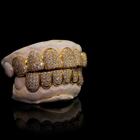 Custom Moissnaite Diamond Grillz In 14K Yellow Gold