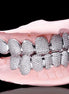 Lab Created Moissanite 10K White Gold Plated Diamond Grillz