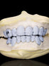 Round Cut Moissanite Customize Letter Grillz