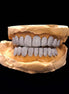 925 Sterling Silver Moissanite Grillz For Men's / Women's