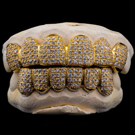 Yellow Gold Plated Moissanite Diamond Custom Grillz