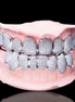 Custom Moissanite Diamond Cluster Grillz For Men's