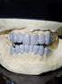 14K White Gold Moissanite Diamond Hip Hop Grillz