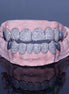 D Color Moissanite 8 On 8 Customize Hip Hop Grillz