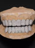 VVS1 Clarity Moissnaite Diamond Teeth Grillz