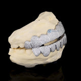 Iced Moissanite Diamond Custom Grillz 10 Top And 10 Bottom Grillz