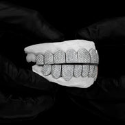 Moissanite Diamond Custom Grillz
