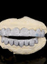 Luxury Moissanite Diamond Custom Grillz