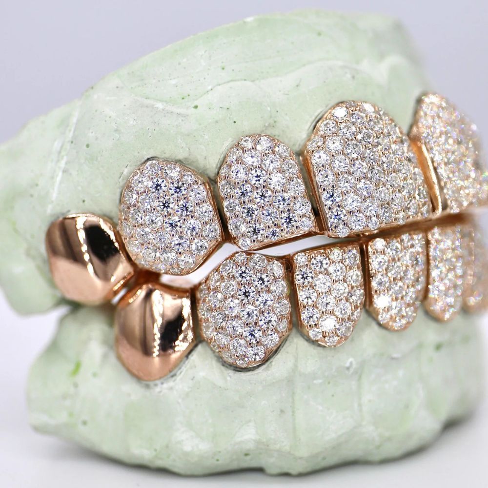 925 Sterling Silver 8 On 8 Moissanite Hip Hop Grillz