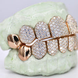 925 Sterling Silver 8 On 8 Moissanite Hip Hop Grillz
