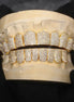 Handcrafted Customize 14K Yellow Gold Plated Moissanite Grillz
