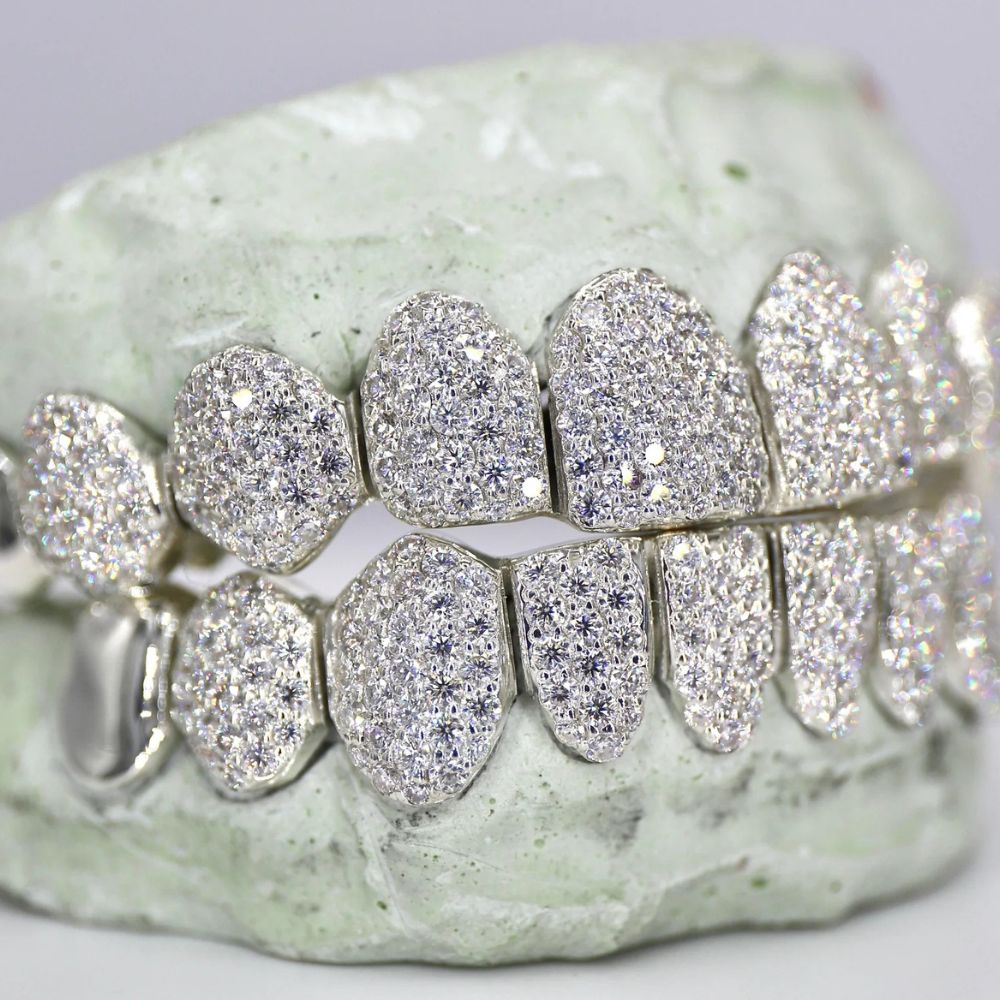 Hip Hop Iced Out Moissanite Customize Grillz