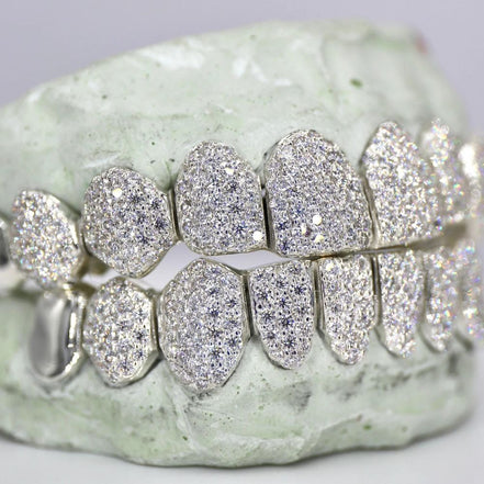 Hip Hop Iced Out Moissanite Customize Grillz