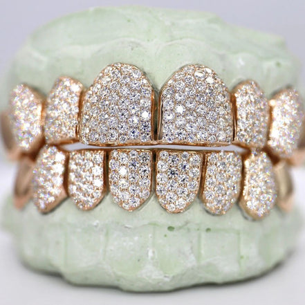925 Sterling Silver 8 On 8 Moissanite Hip Hop Grillz
