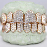 925 Sterling Silver 8 On 8 Moissanite Hip Hop Grillz