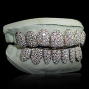 10k White Gold Iced Out 8 On 8 Moissanite Grillz