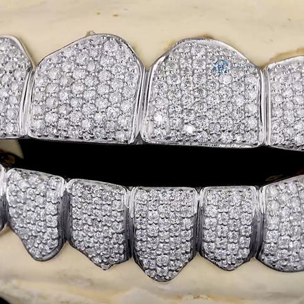 Luxury Moissanite Diamond Custom Grillz