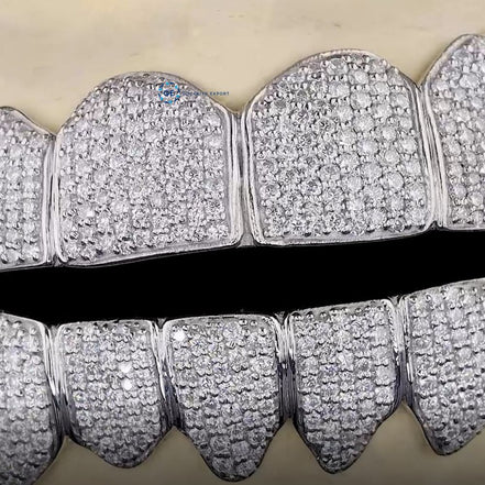Iced Moissanite Diamond Custom Grillz 10 Top And 10 Bottom Grillz