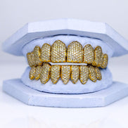 Hip Hop Iced Out Moissanite Grillz