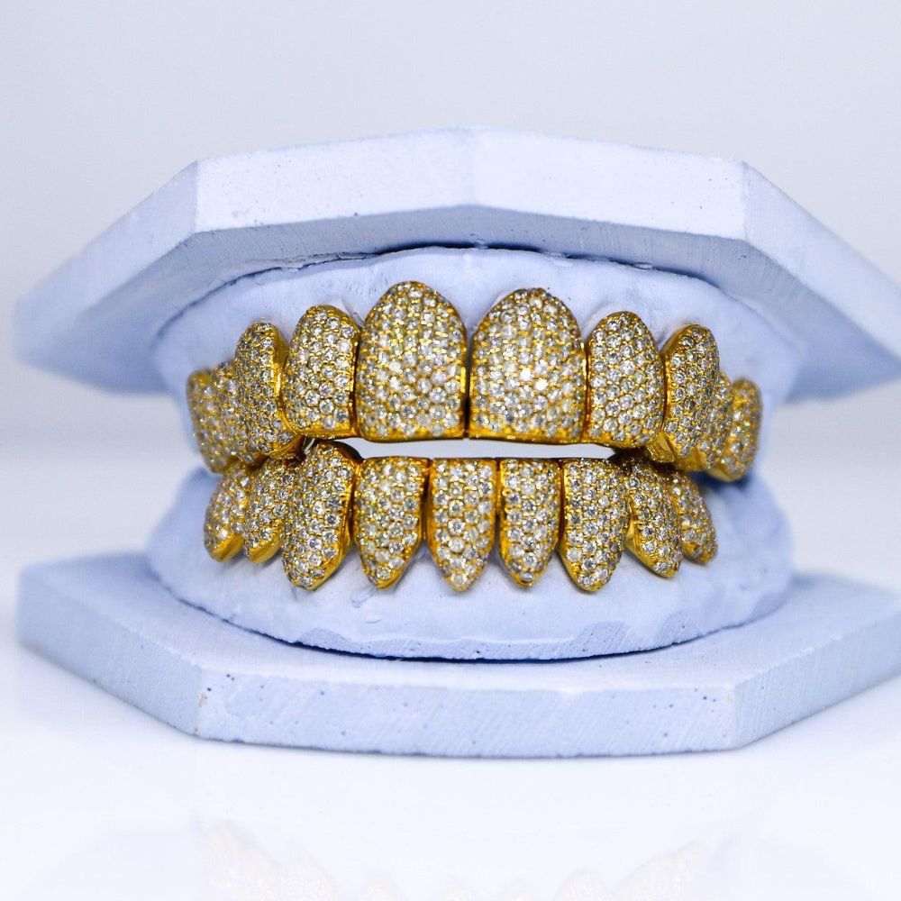 Hip Hop Iced Out Moissanite Grillz