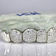 Hip Hop Iced Out Moissanite Customize Grillz
