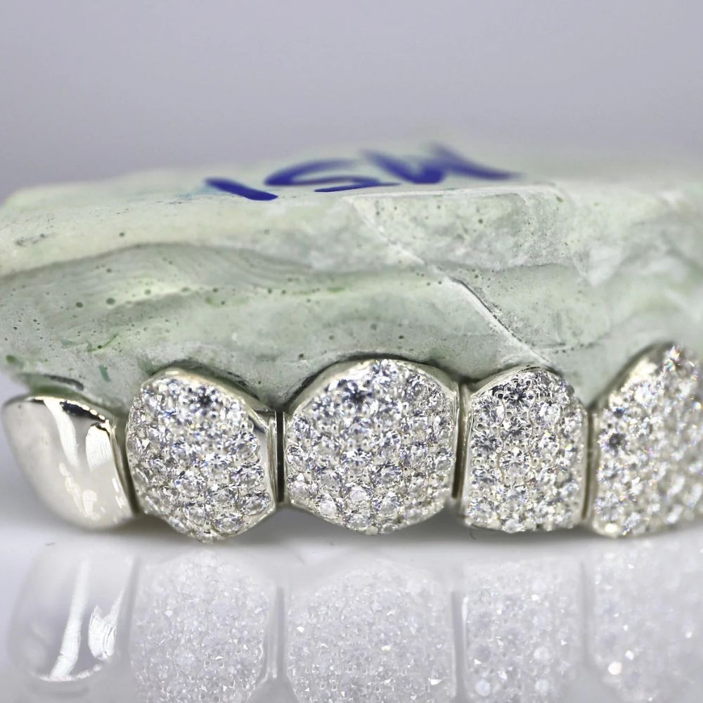 Hip Hop Iced Out Moissanite Customize Grillz