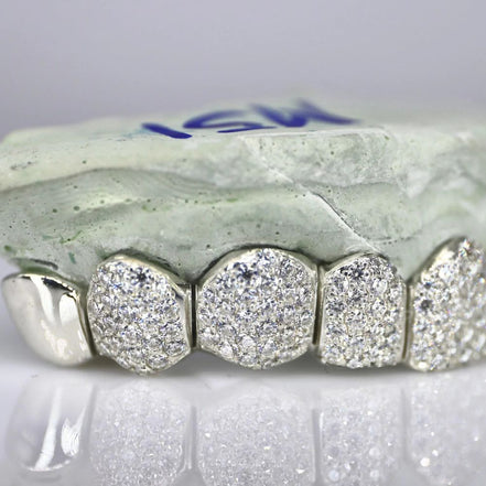 Hip Hop Iced Out Moissanite Customize Grillz